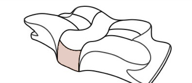 The step between the wing and the centre shaded