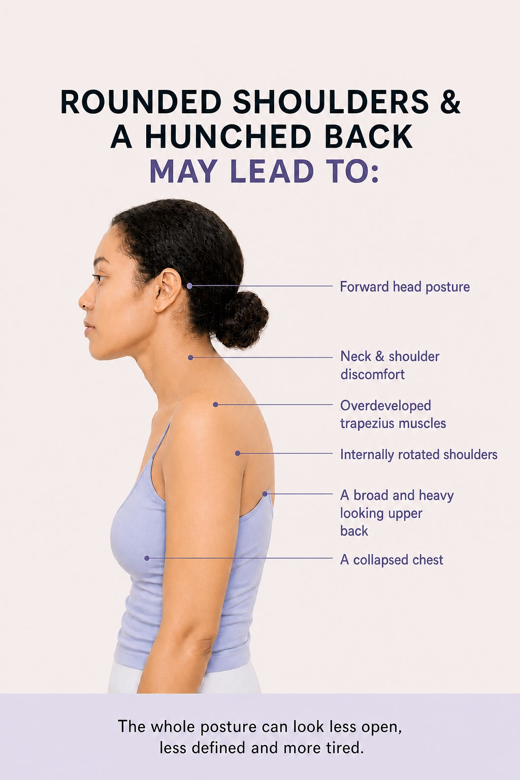 English posture guide showing the possible effects of rounded shoulders and a hunched back